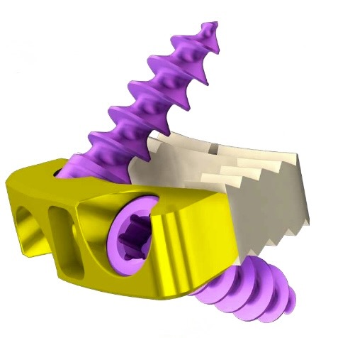 ChM Cage